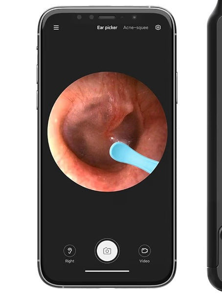 Ear Wax Removal Tool, Ear Cleaner with 1080P HD Camera, Ear Cleaning Kit with 7 PCS Ear Set Wireless Otoscope with 6 Lights for iPhone, iPad, Android